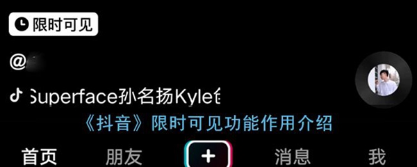 抖音限时可见图标怎么添加